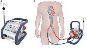 Cardiohelp system